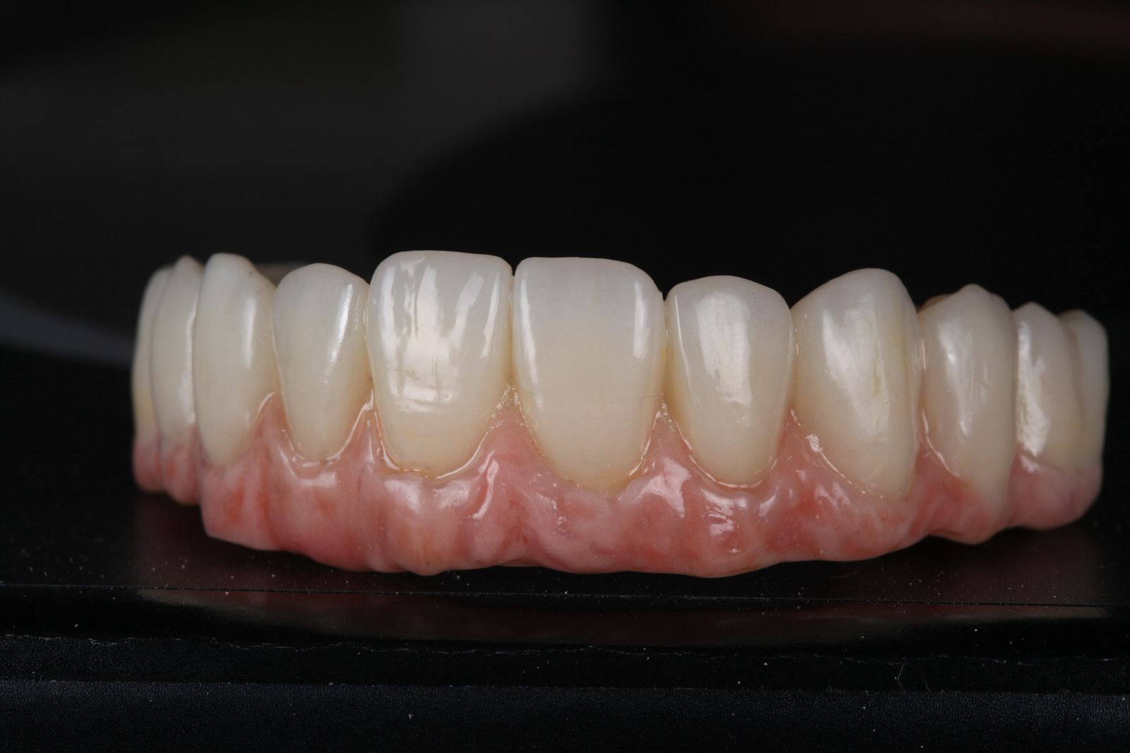 Estética avançada — harmonização do sorriso
